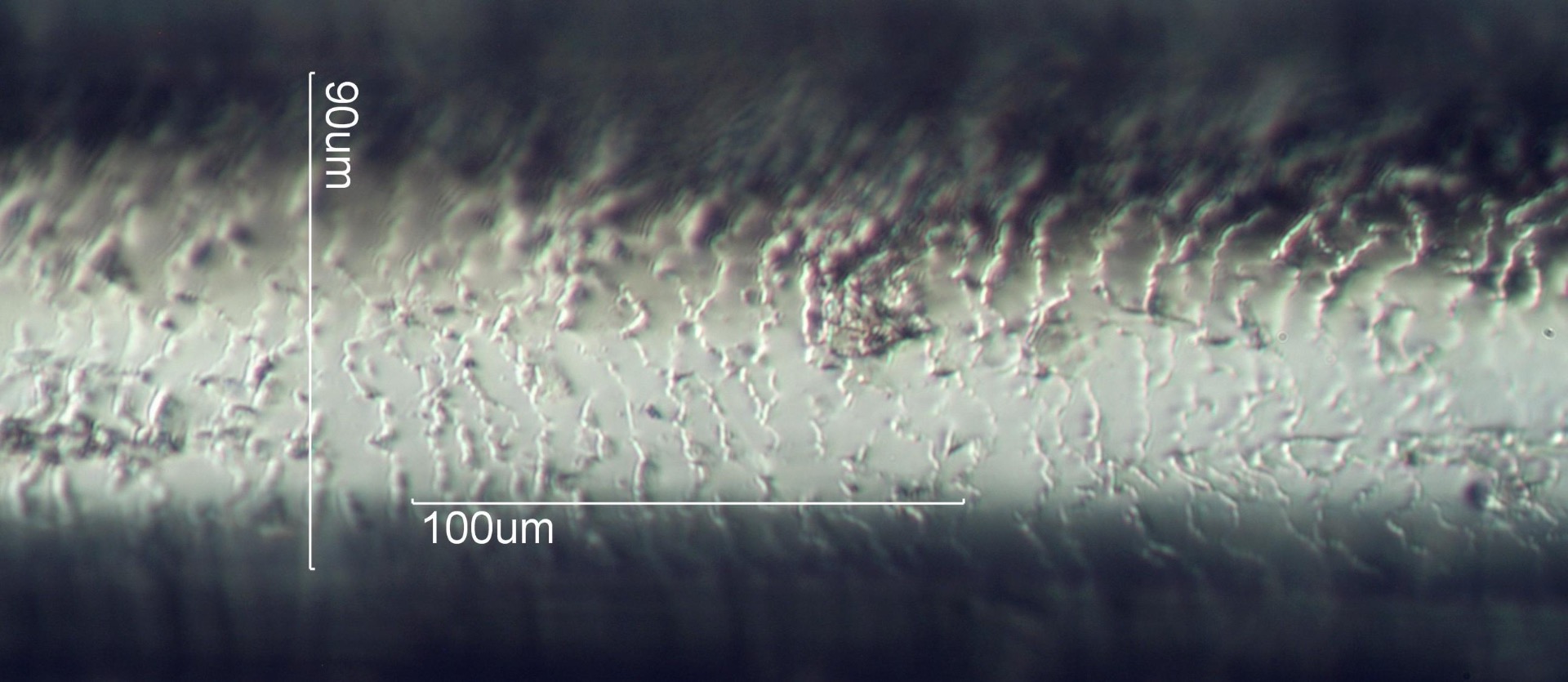 Microscopic image of a horse hair showing the scale-like edge